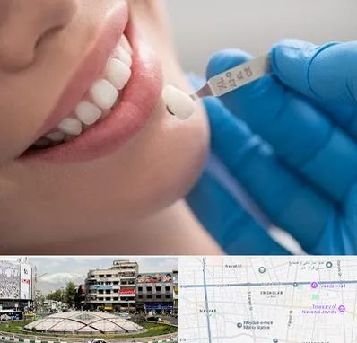 مرکز لمینت دندان در مرکز تهران