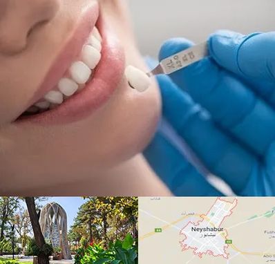 مرکز لمینت دندان در نیشابور