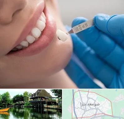 مرکز لمینت دندان در صومعه سرا