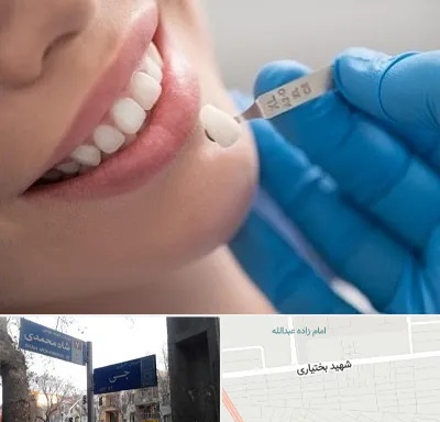 مرکز لمینت دندان در سی متری جی