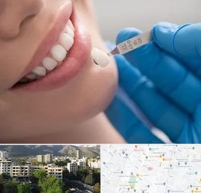 مرکز لمینت دندان در دیباجی