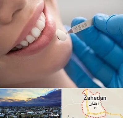 مرکز لمینت دندان در زاهدان
