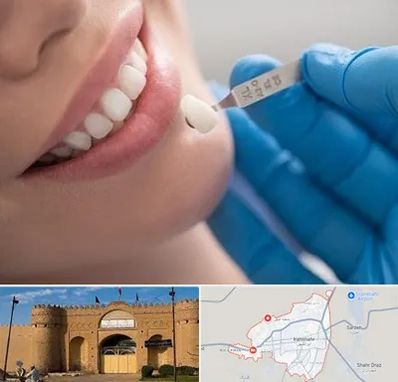 مرکز لمینت دندان در ایرانشهر