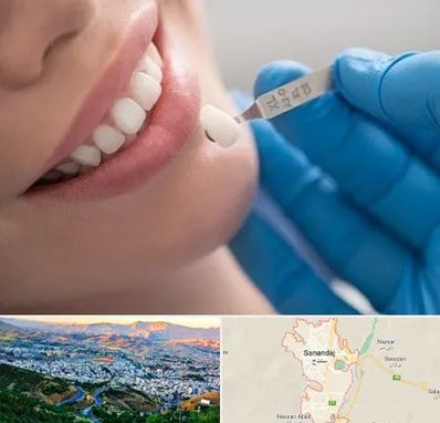 مرکز لمینت دندان در سنندج