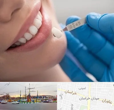 مرکز لمینت دندان در میدان خراسان