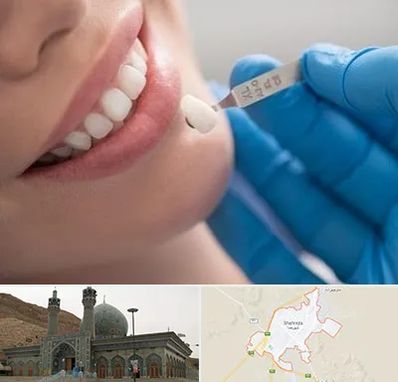 مرکز لمینت دندان در شهرضا