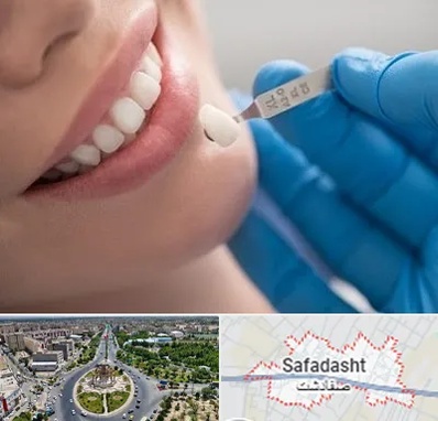 مرکز لمینت دندان در صفادشت