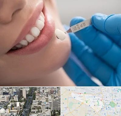 مرکز لمینت دندان در منطقه 18 تهران