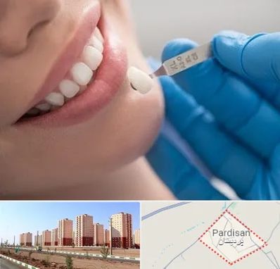 مرکز لمینت دندان در پردیسان قم