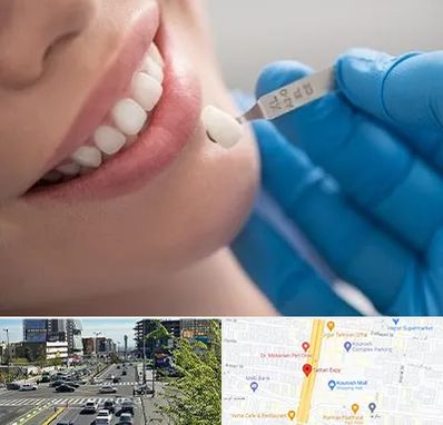 مرکز لمینت دندان در ستاری