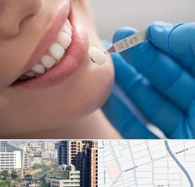 مرکز لمینت دندان در خیابان بهشتی