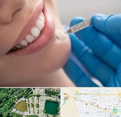 مرکز لمینت دندان در وکیل آباد مشهد