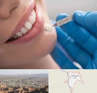 مرکز لمینت دندان در اسفراین