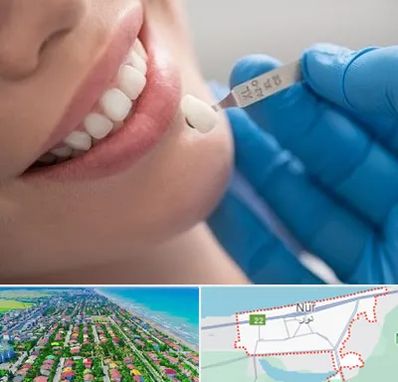 مرکز لمینت دندان در نور