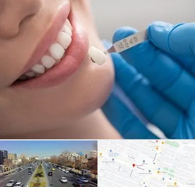 مرکز لمینت دندان در بلوار معلم مشهد