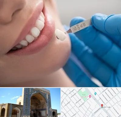 مرکز لمینت دندان در مصلی مشهد