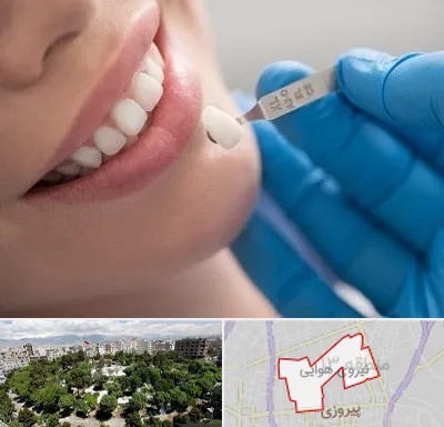مرکز لمینت دندان در نیروی هوایی