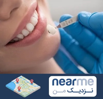 مرکز لمینت دندان در نزدیک من