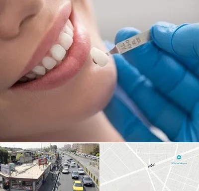 مرکز لمینت دندان در خیابان دماوند