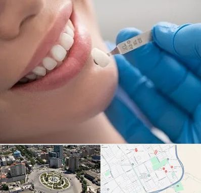 مرکز لمینت دندان در زرافشان اسلامشهر