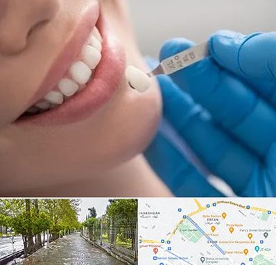 مرکز لمینت دندان در خیابان ارم شیراز