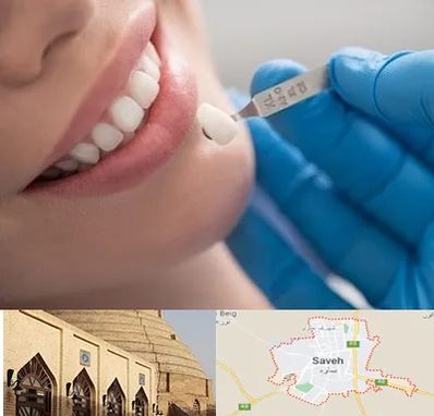 مرکز لمینت دندان در ساوه