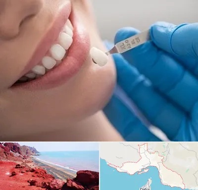 مرکز لمینت دندان در هرمزگان