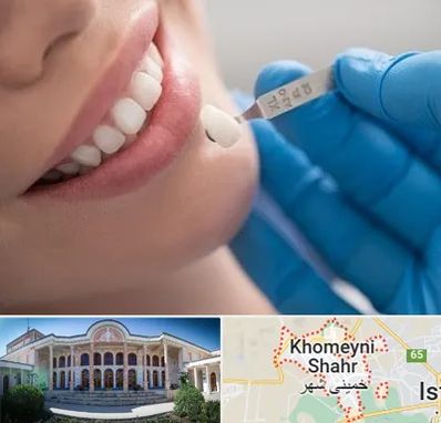 مرکز لمینت دندان در خمینی شهر