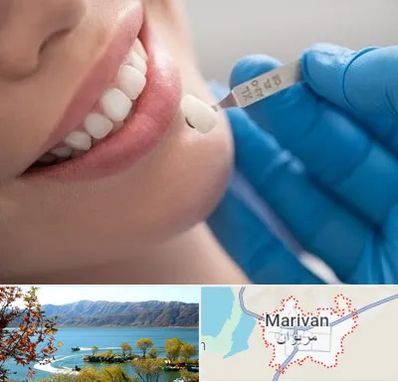 مرکز لمینت دندان در مریوان