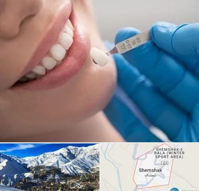 مرکز لمینت دندان در شمشک