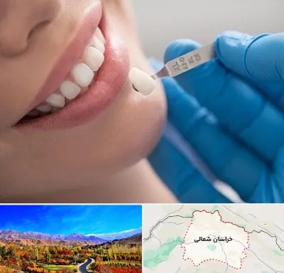 مرکز لمینت دندان در خراسان شمالی