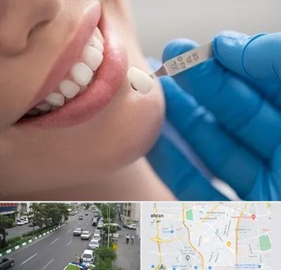 مرکز لمینت دندان در ستارخان