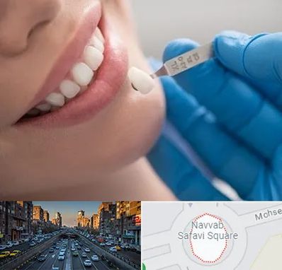 مرکز لمینت دندان در نواب