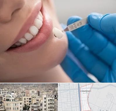 مرکز لمینت دندان در اسکندری