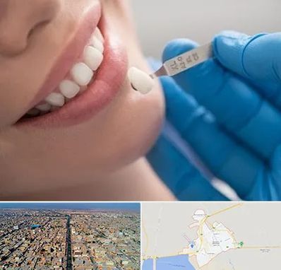 مرکز لمینت دندان در بندر ماهشهر