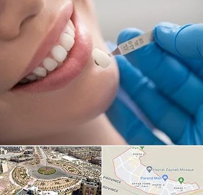 مرکز لمینت دندان در پرند