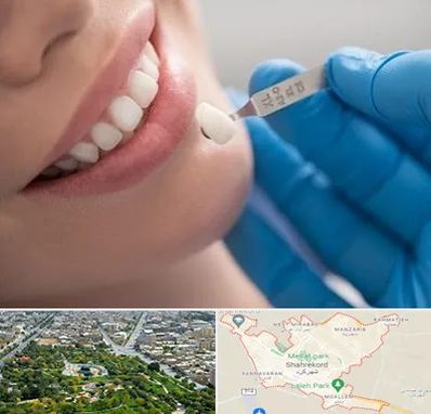 مرکز لمینت دندان در شهرکرد