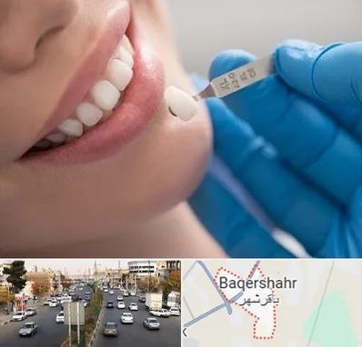 مرکز لمینت دندان در باقرشهر