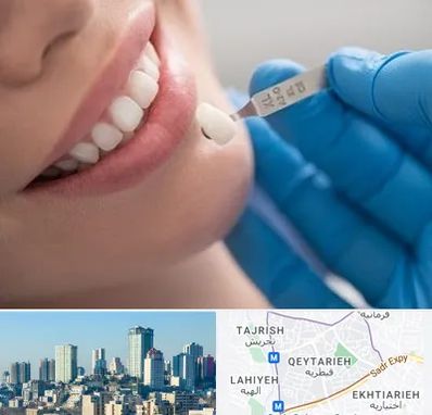 مرکز لمینت دندان در قیطریه