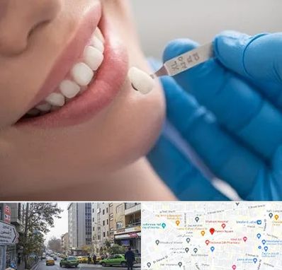 مرکز لمینت دندان در فاطمی