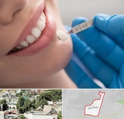 مرکز لمینت دندان در جماران