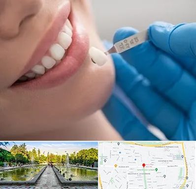 مرکز لمینت دندان در سرسبز