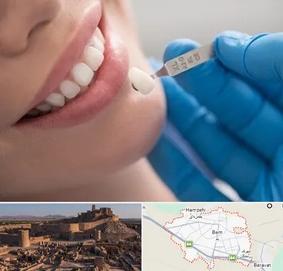 مرکز لمینت دندان در بم