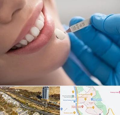مرکز لمینت دندان در خیابان نیایش شیراز