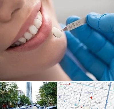 مرکز لمینت دندان در امامت مشهد