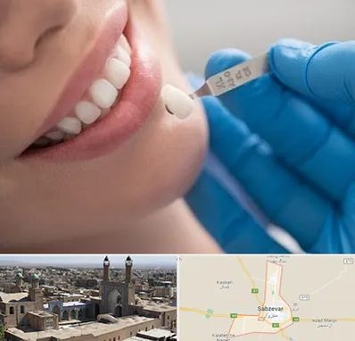 مرکز لمینت دندان در سبزوار