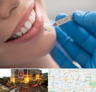 مرکز لمینت دندان در جنت آباد تهران