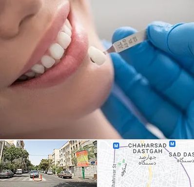 مرکز لمینت دندان در چهارصد دستگاه