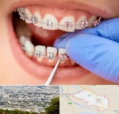 مرکز ارتودنسی دندان در یاسوج