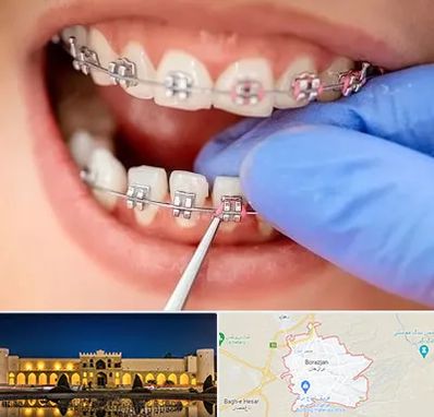 مرکز ارتودنسی دندان در برازجان